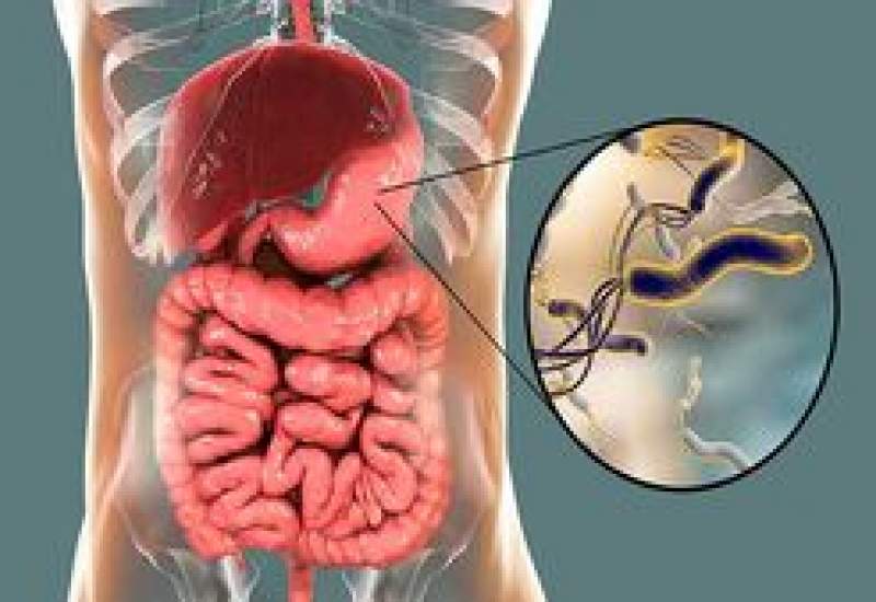 خوراکی‌هایی برای نابودی میکروب معده
