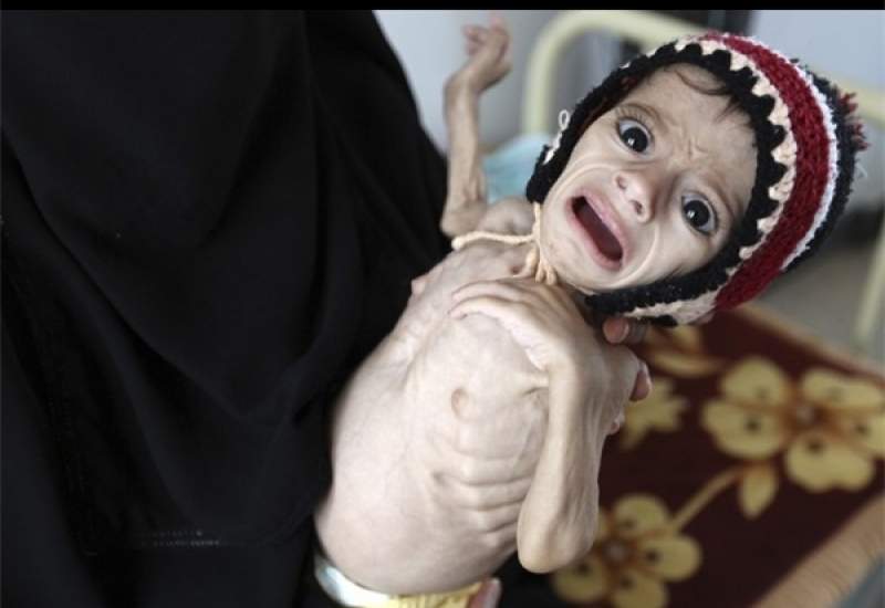 یمن با بدترین بحران انسانی در جهان مواجه است