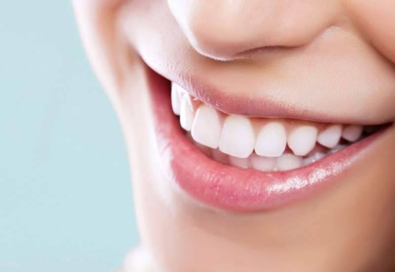 علت زردی دندان چیست و برای سفید کردن دندان ها چه کنیم؟