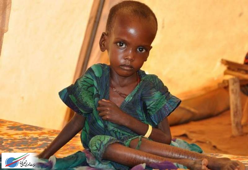 یونیسف: یک‌سوم کودکان جهان از سوءتغذیه یا اضافه‌وزن رنج می‌برند