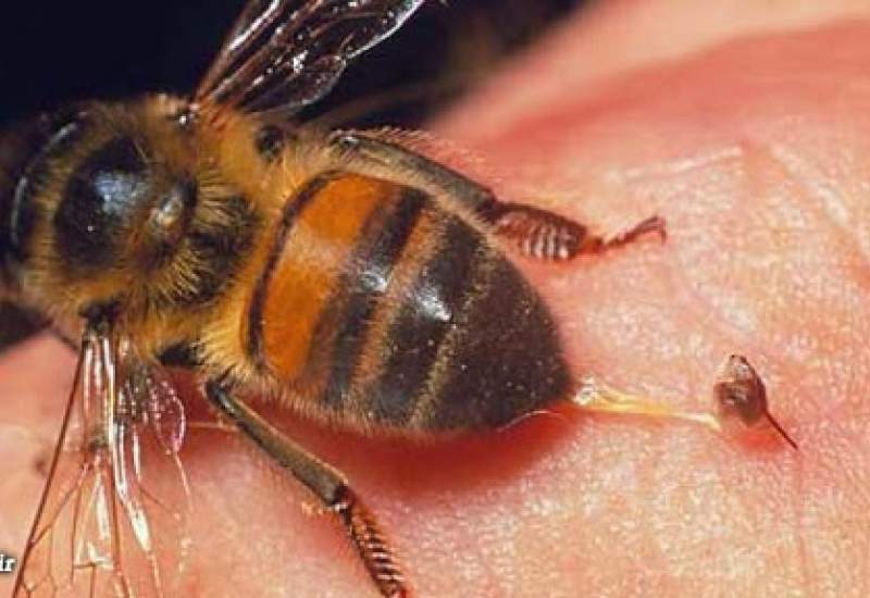 کارشناس تلویزیون: نیش زنبوردرمان کروناست!