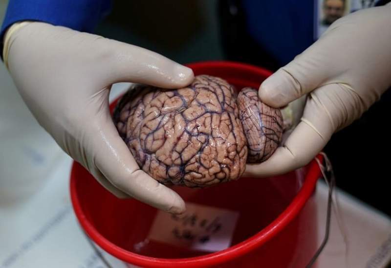 تاثیرات شدیدی که کرونا ممکن است بر مغز بگذارد / مغز برخی بیماران ۱۰ سال پیر شده است