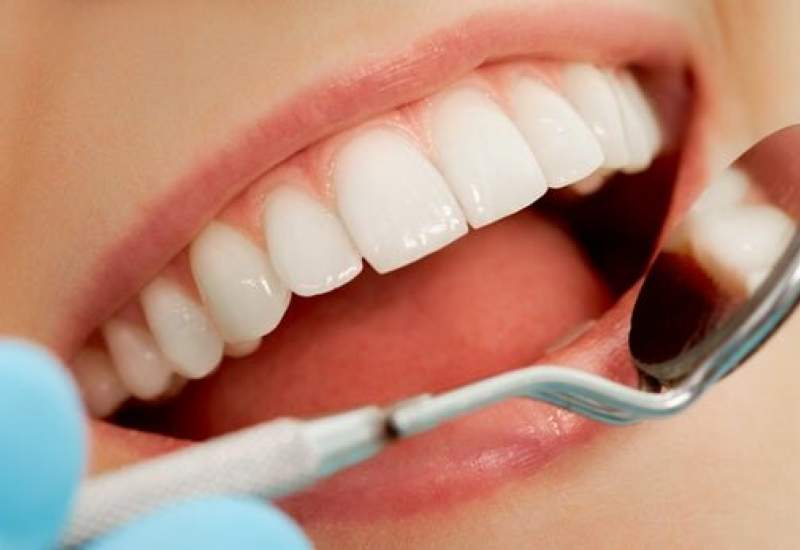 فرمول غذایی برای سفیدکردن دندان‌ها