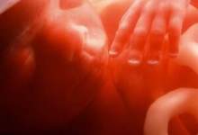 دیه «جنین سقط شده صاحب روح» ۴۸۰ میلیون تومان! + جزئیات