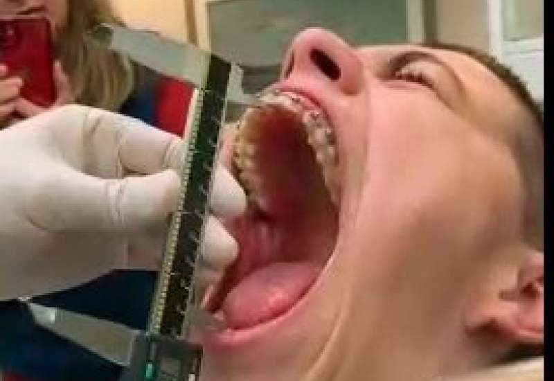 (فیلم) دهن گشادترین آدم دنیا