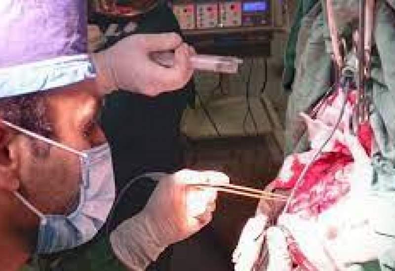انجام عمل موفقیت آمیز و نادر مغز در حالت بیداری در بیمارستان شهید بهشتی یاسوج