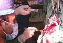 انجام عمل موفقیت آمیز و نادر مغز در حالت بیداری در بیمارستان شهید بهشتی یاسوج