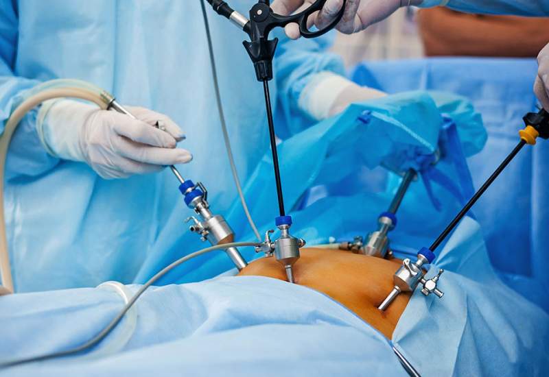 درمان سرطان معده به روش نوین در بیمارستان جلیل یاسوج