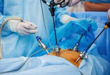 درمان سرطان معده به روش نوین در بیمارستان جلیل یاسوج