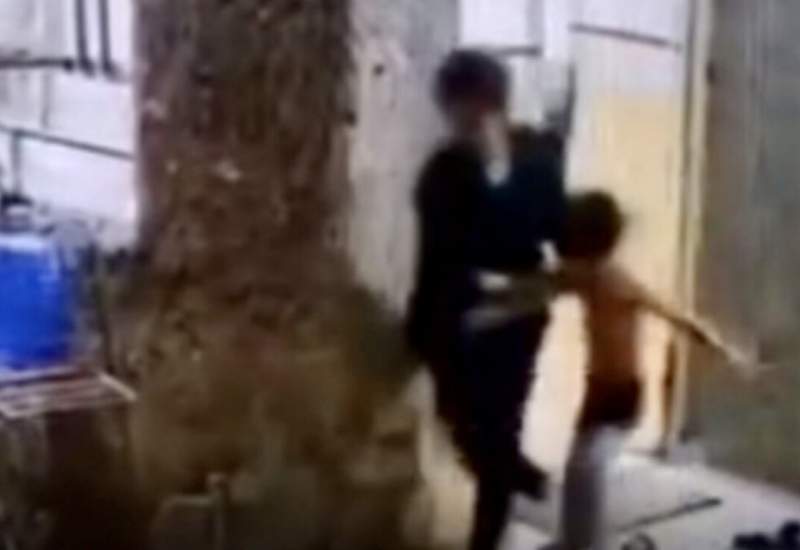 (۱۶+) تصاویر نامردی نامادری ارومیه‌ای که در فضای مجازی دست به دست می‌شود / کودک چهارساله ضربه مغزی شد!