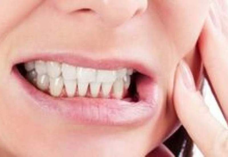 این نوع دندان درد از علائم سرطان است