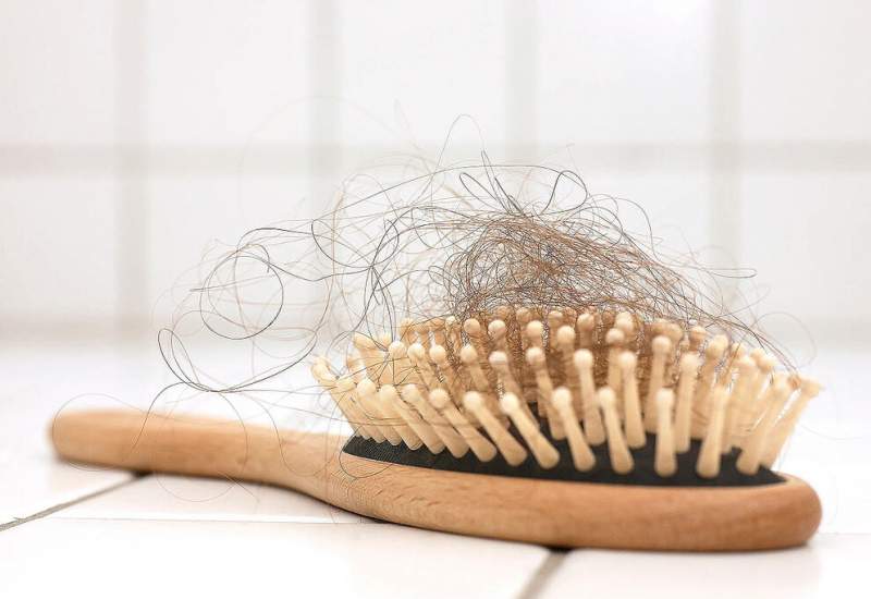 علت ریزش مو در زنان کمبود چه ویتامینی است ؟ / دلایل ریزش مو در زنان