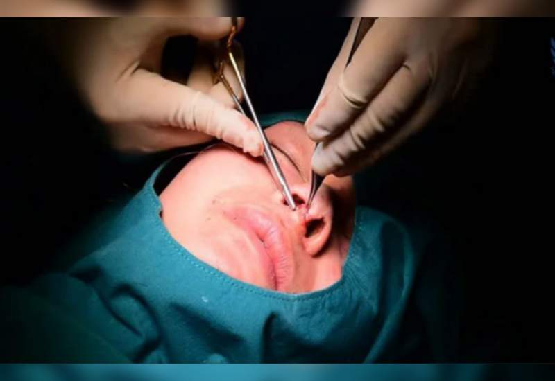 جراحی زیبایی در صدر شکایت از پزشکان کهگیلویه و بویراحمد