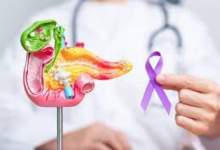 تحولی بزرگ در دنیای علم و پزشکی نوین / پایان سکوت خاموش‌ترین سرطان؛ تشخیص فقط با یک قطره خون